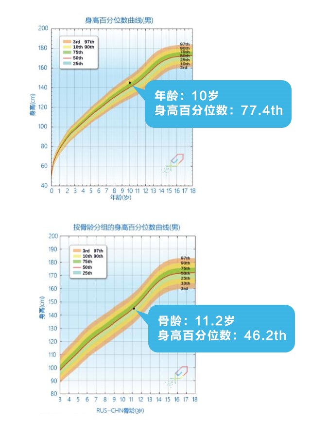 如何正確理解，科學評價孩子的身高？_06.jpg