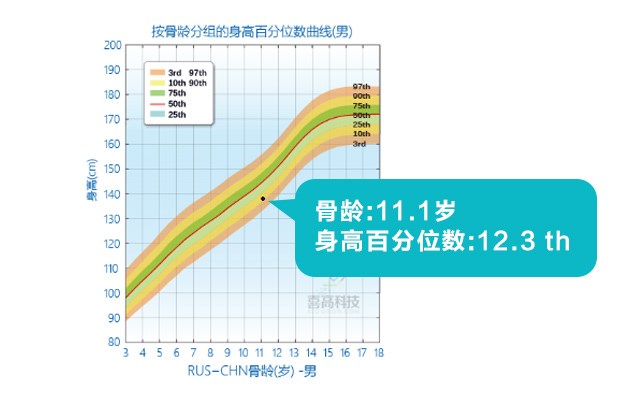 判斷孩子的高矮？這3點(diǎn)沒搞清楚會(huì)后悔！_05.jpg