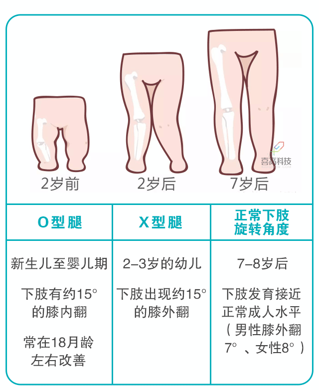 寶寶身長腿短，長大會是矮個子嗎？_03.gif